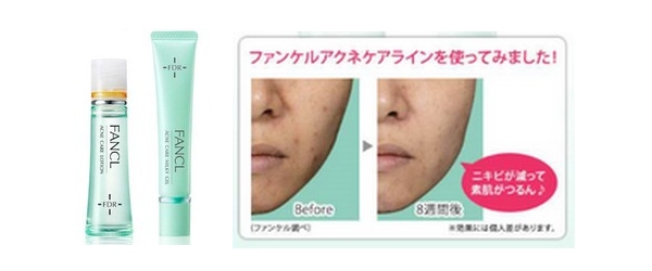 アクネケアたっぷりおためしキットについて